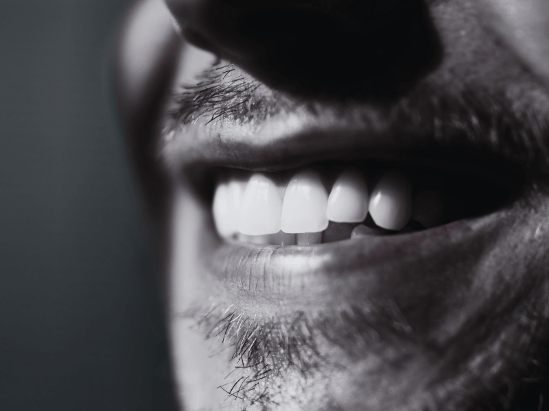 Implantes dentales | EVIDENTAL Sarrià Paciente con implantes dentales sonriendo en EVIDENTAL, clínica dental en Sarrià, Barcelona.
