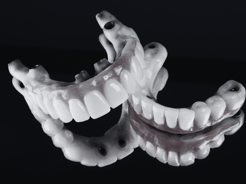 Prótesis dentales en Sarrià | EVIDENTAL Barcelona Prótesis dental removible utilizada para recuperar dientes perdidos en EVIDENTAL, Sarrià (Barcelona).